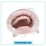 دهان باز کن اپتراگیت ایوکلار – IVOCLOR